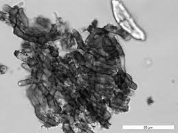 L0x eyepieces with howard mold count or other eyepiece grid; Hyphae Of Sooty Mould Under The Microscope Download Scientific Diagram