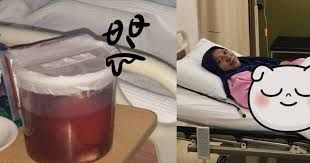Warna darah haid kok coklat sih bahkan sampai kehitaman? Jangan Padang Remeh Kalau Keluar Darah Haid Yang Berpanjang Berserta Ketulan Wanita Ini Kongsi Kisah Darah Rendah Fibroid