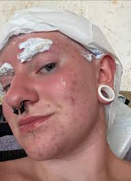 Can someone please help me know the order I should be using these ? I'm 32  this month and this is my skin, no filter I wash my face twice a day