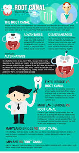 The Root Canal Controversy Holistic Dentist Paige Woods Root Canal Dental Fun Holistic Dentist