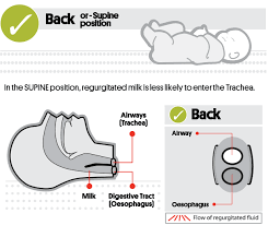 Opening the airway is an important part of any initial assessment to ensure that we keep the airway clear and free from obstructions. Will Baby Choke If He She Vomits While Sleeping On The Back Red Nose Australia