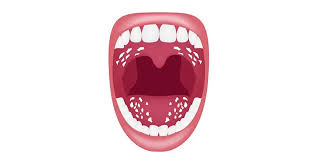 Image result for oral thrush symptoms roof of the mouth