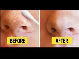 Pin On Beauty Tips