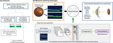 Image result for Refractive Error