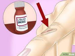 How To Treat A Paper Cut (With Pictures) - Wikihow