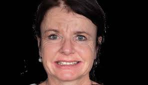 PRETTAU® 3 DISPERSIVE®