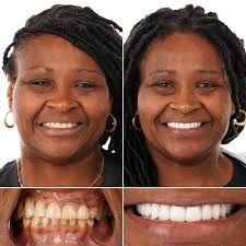 TOP 10 BEST Cosmetic Dentists near Denham Springs, LA