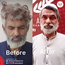 Success Story of Malik Rauf Foundation. Alhamdullillah! Another patient of  ours, who was a drug addict, has been treated free of cost for three months  at our hospital, Da Haq Awaz Organization,
