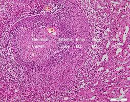In the adult, the spleen functions mainly as a blood filter as the spleen is a highly vascular organ, its rupture results in profuse bleeding into the peritoneal cavity. The Human Spleen As The Center Of The Blood Defense System Springerlink