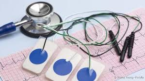 Vorhofflimmern Ursache Diagnose Und Behandlung Netdoktor