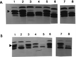 Meciurile de acest fel sunt des folosite pentru a ajuta antrenorii în alegerea jucătorilor pentru meciurile. Pbp Profiles A Effect Of Meci Inactivation And Or Mecr1 Meci Present Download Scientific Diagram