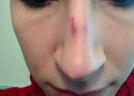 After you pull the strip off, there's usually some adhesive still stuck to the nose and you want to make sure you really wash that off since it . Biore Deep Cleansing Charcoal Pore Strips Reviews Makeupalley
