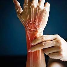 It can also help heal damaged tissues. Rheumatoid Arthritis Ra Early Signs Symptoms Causes Treatment Diet