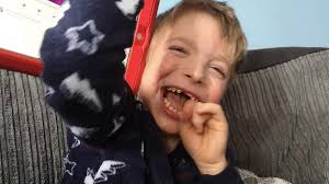 MEDICINSKA MISTERIJA Oliver (7) ne govori i ima brojne poremećaje, a niko  ne zna ŠTA MU JE (FOTO)