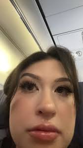 Hi everyone. I have been dreaming of plastic surgery