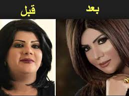 ٤ رجيم كسر ثبات الوزن.يتم أخذ عينة من الأنسجة من منطقة الرئة المشتبه فيها ويتم. Ø´Ø§Ù‡Ø¯ Ø§Ù„ÙÙ†Ø§Ù†Ø© Ø§Ù„Ù‡Ø§Ù… ÙØ¶Ø§Ù„Ø© Ù‚Ø¨Ù„ ÙˆØ¨Ø¹Ø¯ Ø¹Ù…Ù„ÙŠØ§Øª Ø§Ù„ØªØ¬Ù…ÙŠÙ„ Ù„Ù† ØªØµØ¯Ù‚ ÙƒÙŠÙ ØªØºÙŠØ± Ø´ÙƒÙ„Ù‡Ø§ ÙˆØ§ØµØ¨Ø­Øª Ø´Ø®Øµ Ø§Ø®Ø± Ø§ÙƒØ«Ø± Ø¬Ù…Ø§Ù„ ÙˆØ§ Youtube