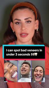 Robert Pattinson's Dental Secrets Revealed