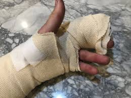 Image result for Hand Injury