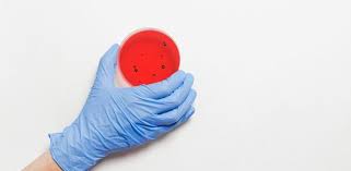 Escherichia coli is one of the most frequent causes of many common bacterial infections, including cholecystitis, bacteremia, cholangitis, urinary tract infection (uti), and traveler's diarrhea, and other clinical infections such as neonatal meningitis and pneumonia. E Coli Si Cancerul Intestinal Exista O Legatura Studiu Cancer360