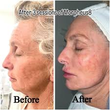 Lasers & Facials Med Spa