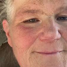 Fundraiser for Andrea Rivera by Cory Hixson : Andrea has stage 4 cancer in  her stomach