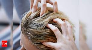 I have open sores on my scalp and was wondering if i can use coconut oil or should i wait until they are healed up? Are You Oiling Your Hair Right Times Of India
