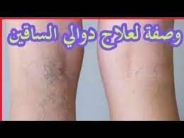 تقوية وتضخيم العضلات بوصفات طبيعية أغذية لتقوية العضلات بسرعة. Ø¹Ù„Ø§Ø¬ Ø¯ÙˆØ§Ù„ÙŠ Ø§Ù„Ø³Ø§Ù‚ÙŠÙ† ÙˆØ§Ù„Ø§ÙˆØ±Ø¯Ø© Ø§Ù„Ø¹Ù†ÙƒØ¨ÙˆØªÙŠØ© Ø¨Ø·Ø±Ù‚ Ø·Ø¨ÙŠØ¹ÙŠØ© 100 ÙØ¹Ø§Ù„Ø© Ùˆ Ø¢Ù…Ù†Ø© Ø¬Ø¯Ø§ Ø¨Ø¥Ø°Ù† Ø§Ù„Ù„Ù‡ Youtube