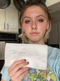 Almost my 19th birthday and someone told me I looked like a Chucky doll. Do your  worst. : rRoastMe