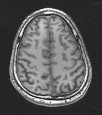 Medical Image Sharing Fast Simple Secure Image32 Protected Health Information Mri Hipaa