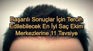En Iyi Sac Ekim Merkezi 2021 Guncel En Basarili Sonuclar Icin 11 Tavsiye Zovovo En Iyi Bilgi Sitesi