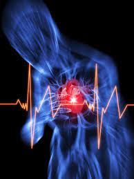 Cardiac arrest is a sudden loss of blood flow resulting from the failure of the heart to pump effectively. Cardiac Arrest Harvard Health