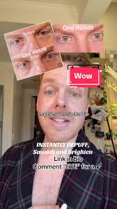 🛒 Ready for a fresh look? Link IN BIO to buy now and transform your eyes! 