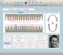 charting exam datacon dental systems