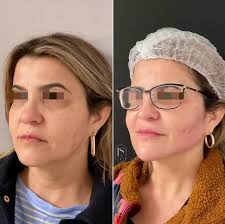 LS Advanced Aesthetics (@lsadvancedaesthetics) • Instagram photos and videos