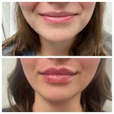 Orchard Park Aesthetics