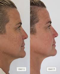 I have no idea why I haven't started looking after my skin like this  before! Thank you Sonya, my skin feels and looks amazing!”