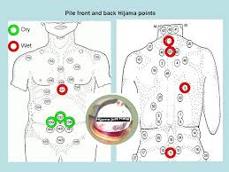 pile front and back arabic hijama points cupping points