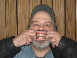 Bill Beaty's Dentition