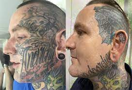 How to remove temporary tattoos easily. Can You Get Rid Of Face Tattoos With Laser Tattoo Removal