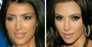 We did not find results for: Pin By Jasmine Sanchez On Kim Kardashian West Kim Kardashian Before Hair Implants Plastic Surgery