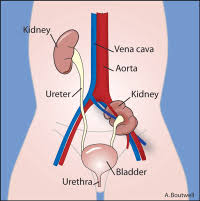 · renal tuberculosis (constant pelves. Fetal Horseshoe Kidney Fetal Pelvic Kidney Lurie Children S