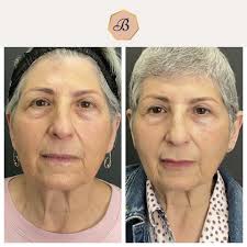 Beth Mallon (@bamaestheticswellness) • Instagram photos and videos