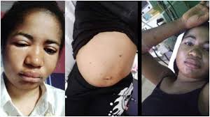 Legit.ng is on a mission to support vulnerable children human rights activist gwamnishu emefiena harrison, who has been taking care of the comedian, confirmed to legit.ng via a phone call that ada is dead. Comedienne Ada Jesus Hospitalised With Kidney Problem Entertainment News And Jobs Portal