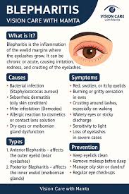 Image result for Blepharis sol