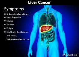 When this happens it usually leads to benign tumors, such as hemangiomas. What Are The Warning Signs Of Liver Cancer Signs And Symptoms Of Cervical Cancer Chicken Pox