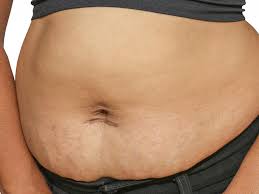 Your Post Baby Belly Why It S Changed And How To Tone It Babycentre Uk
