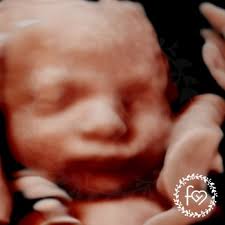 FOREVER YOURS ULTRASOUND