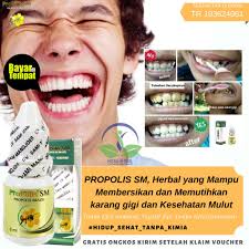 Sedangkan untuk membersihkan gigi bagian depan, posisikan sikat gigi secara vertikal atau gunakan ujung kepala sikat gigi. Obat Pemutih Gigi Kuning Hitam Penghilang Pembersih Karang Gigi Penyegar Bau Mulut Herbal Alami Shopee Indonesia