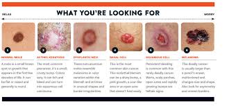 It is the very color that reflects your character. after reviewing the findings of many experts, bright side shows you how your favorite color characterizes you in the eyes of people around you. We Re In Trouble Skin Cancer Is On The Rise And Not Just For Golfers