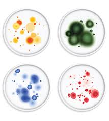 Maybe you would like to learn more about one of these? Black Mold Removal Remediation Services In San Diego